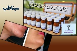 توصيه هاي غذايي برای مبتلایان به ام اس