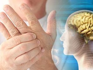 خستگي در بیماران ام اس