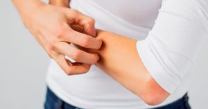 درمان های خانگی برای از بین بردن خارش کف سر