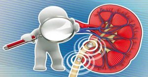 اثر دیابت بر کلیه ها