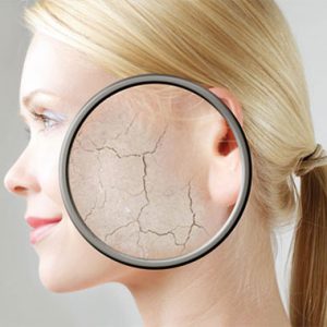 درمان خشکی پوست