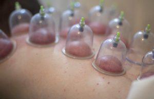 در چه شرایطی حجامت ممنوع است؟