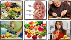 رژیم غذایی در بیماران مبتلا به سنگ کلیه