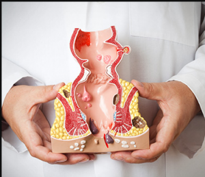 رابطه گوشت و چربى با سرطان روده بزرگ‏