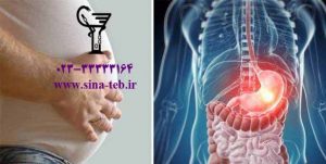 چرا دچار نفخ دستگاه گوارش میشویم؟