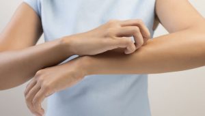 شوره پوست بدن‏